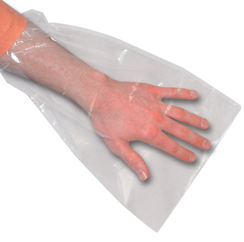 Burn Bag For Hands - Sterile - Each